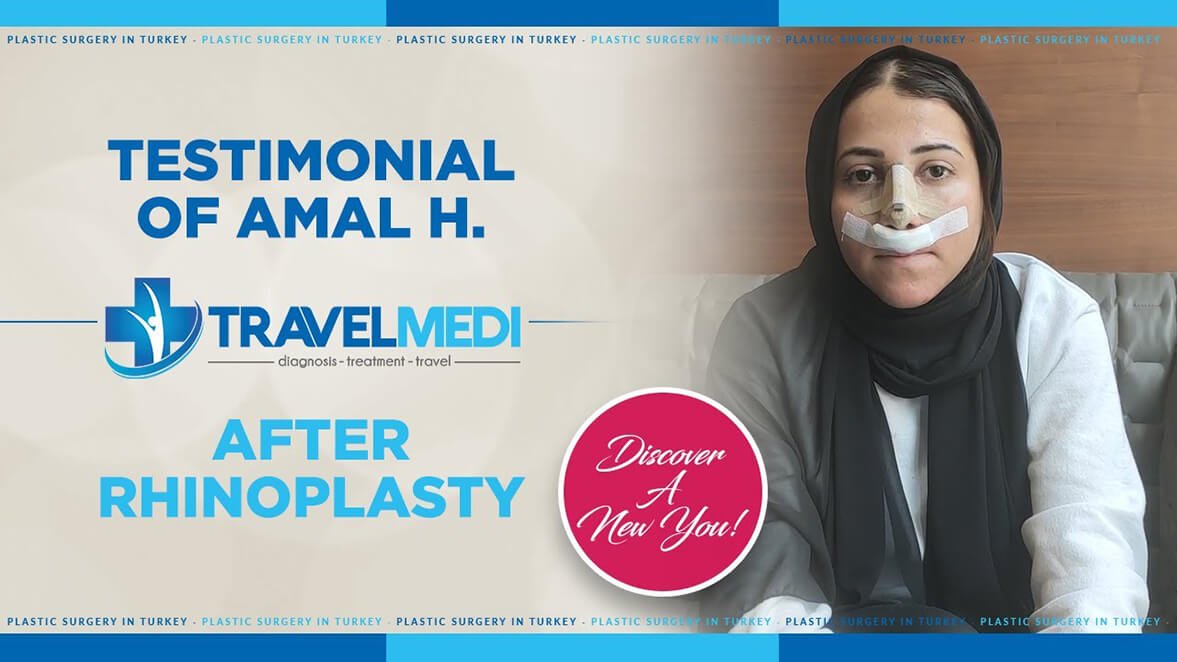 Video testimonial after rhinoplasty in Turkey