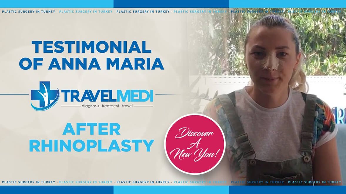 Video review after nose job surgery in Turkey