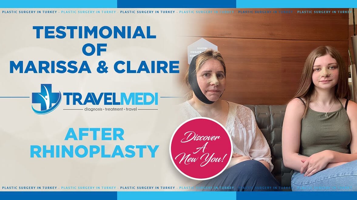 Video review after nose job in Turkey